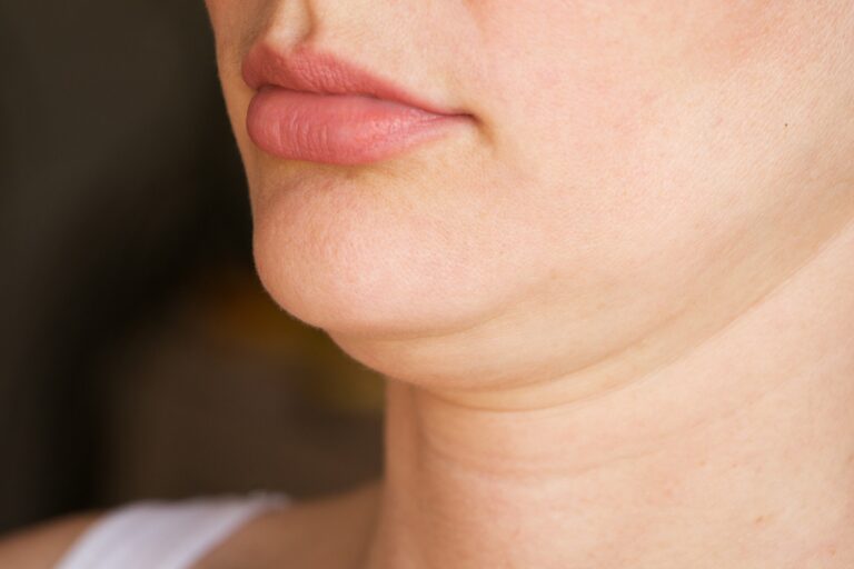 How to Get Rid of a Double Chin Without Surgery