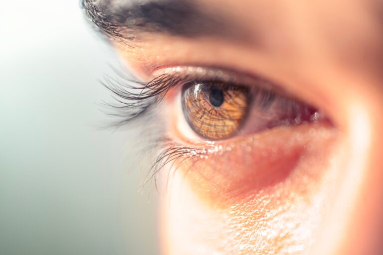 Sunken Eyes: Causes and Treatment Options